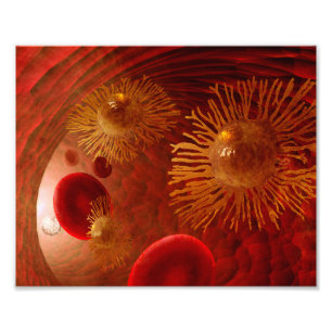 Foto Poster da metástase do cancer