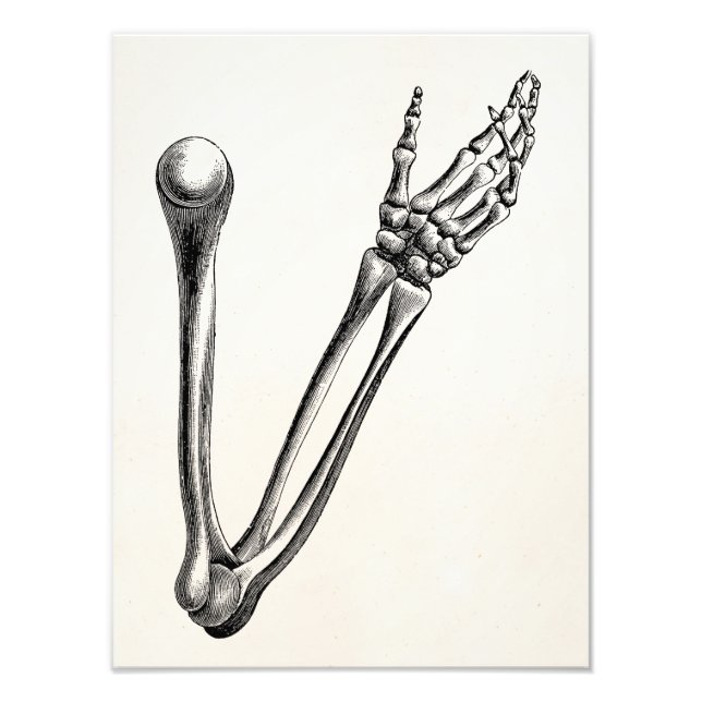Foto Vintage Skeleton Arm Bone Personalizado Ossos Retr (Frente)