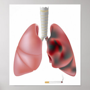 Fumando e poster do câncer pulmonar