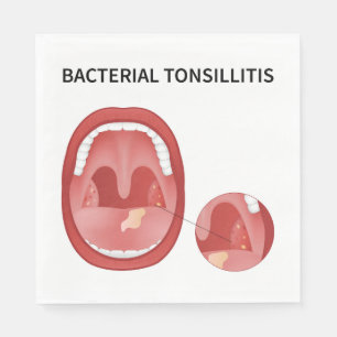 Guardanapo De Papel Tossilite bacteriana