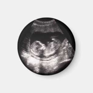 Íman Anúncio de gravidez de ultrassom personalizado par