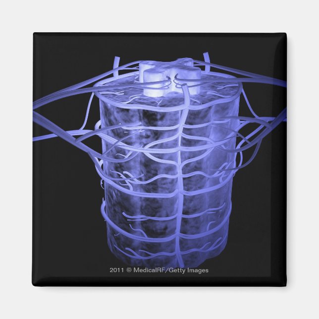 Íman Artérias que circundam parte da coluna vertebral (Frente)