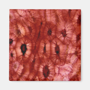 Íman Células esclerenchymas de poço de cereja