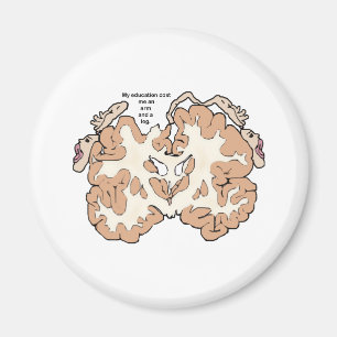 Íman Custa um braço e uma perna homunculada