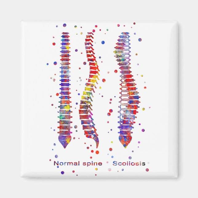 Íman Espinha (Frente)