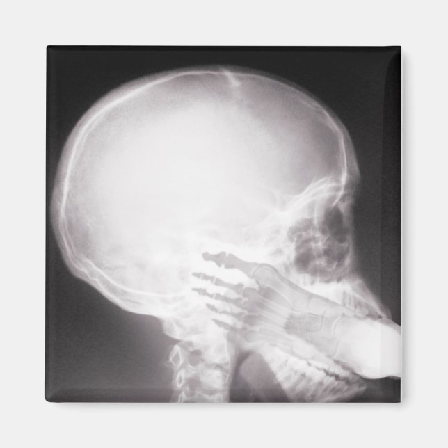 Íman Foto em raio-X da boca (Frente)