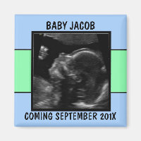 Foto Ultrassônica personalizada do Baby Boy