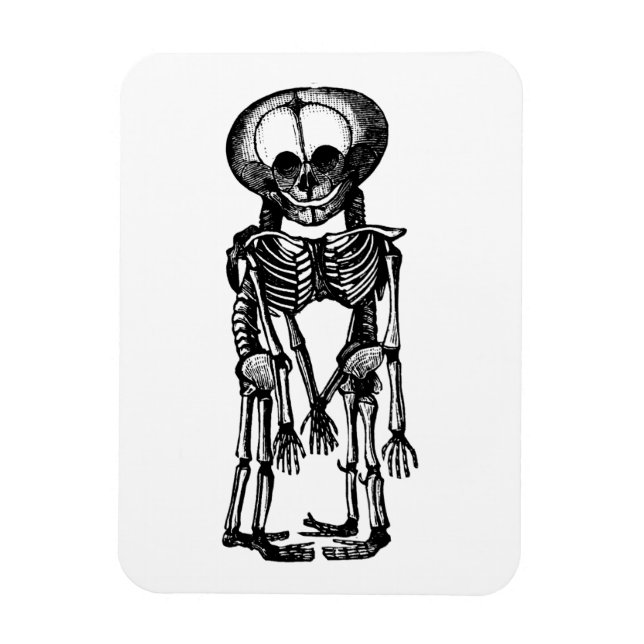 Íman gêmeos siameses esqueletos crianças anatomia arte (Vertical)