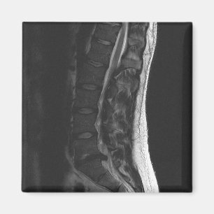 Íman Ímã rompido do disco