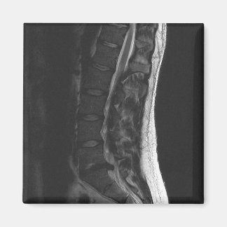 Íman Magneta de Disco Ruptura