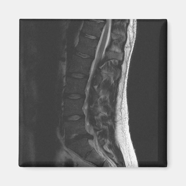 Íman Magneta de Disco Ruptura (Frente)