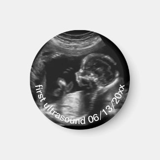 Íman Para Nova Mãe Primeiro Sonograma Ultrassônico