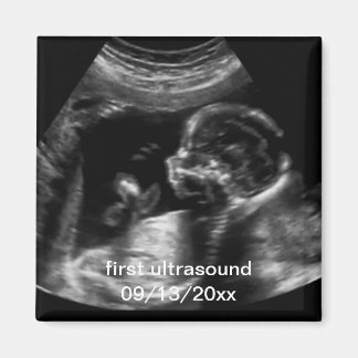 Íman Para Nova Mãe Primeiro Sonograma Ultrassônico