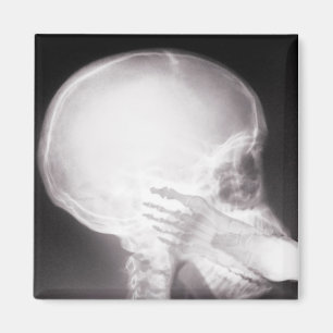 Íman Pé em raios X da Boca