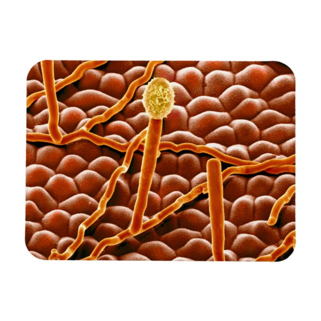 Íman Powdery Mildew Fungus em Poinsettia (Horizontal)