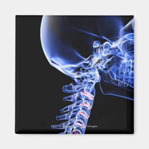 Íman Radiografe a imagem dos ossos do pescoço