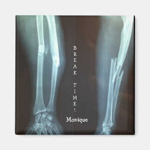 Íman Radius quebrado e Ulna Xray "Break Time"