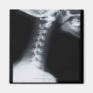 Íman Raio X das vértebras do pescoço que incluem a ma