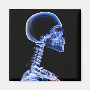 Íman Raio-X dos ossos no pescoço