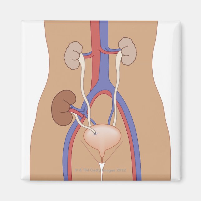 Íman Transplante renal (Frente)