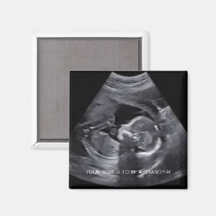 Íman Vai ser uma FOTO de Sonograma Grávida de GRANDMA