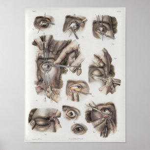 Impressão da anatomia do vintage da técnica da
