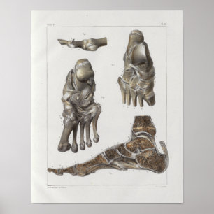 Impressão da anatomia do vintage de 1867 ossos de