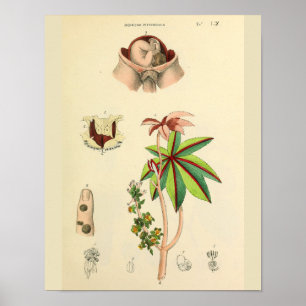 Impressão da arte da anatomia do vintage do úter