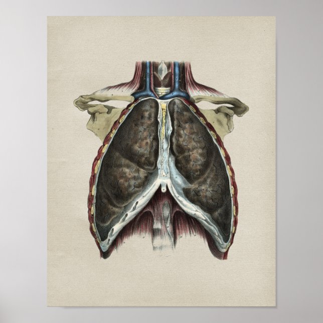 Impressão da Vintage, Anatomia pulmonar do tórax h (Frente)