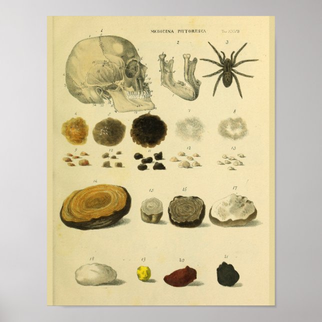 Impressão de Aranha do Crânio Humano Anatomia Médi (Frente)