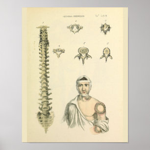 Impressão de Arte da Anatomia das Vertebras da Co