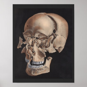 Impressão de Caveira Explosiva Desarticulada