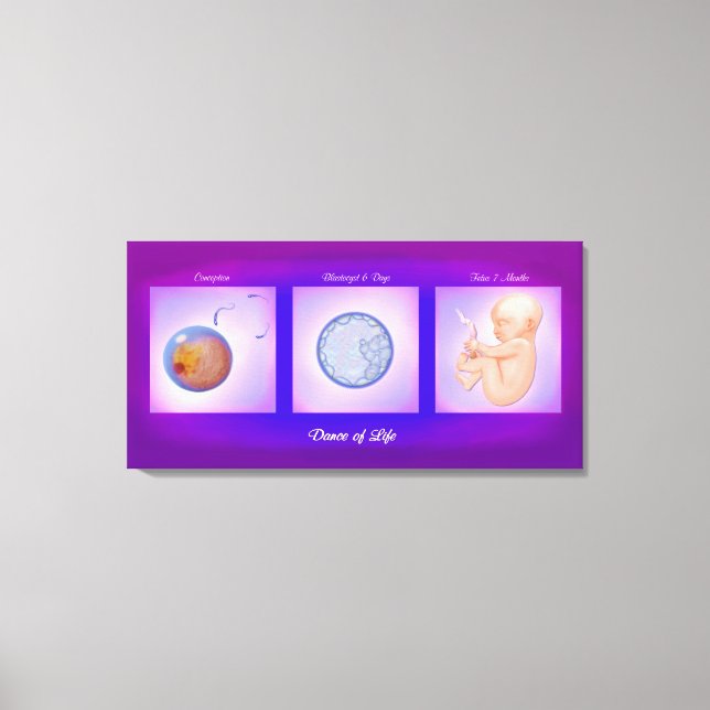 Impressão De Telas De Arte De Gravidez Da Dança De (Frente)