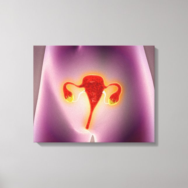 Impressão Em Tela Anatomia Do Corpo Feminino Com Útero (Frente)