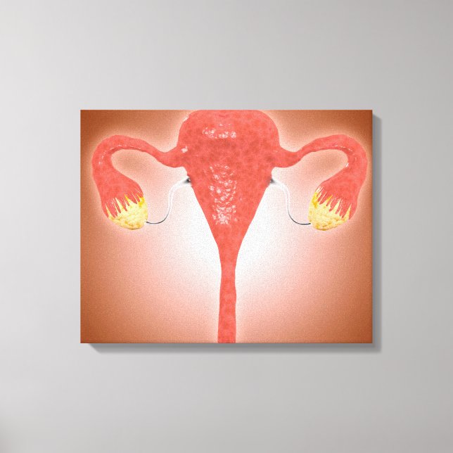 Impressão Em Tela Anatomia Do Útero Feminino Com Ovários (Frente)