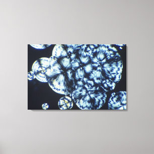 Impressão Em Tela Cristais do colesterol vistos na luz polarizada