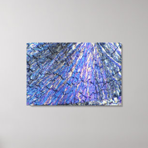 Impressão Em Tela Cristais do colesterol vistos na luz polarizada 2