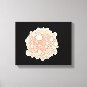 Impressão Em Tela Ideia microscópica da pilha de câncer de pâncre