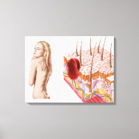 Ilustração De Crescimento Atípico Na Pele