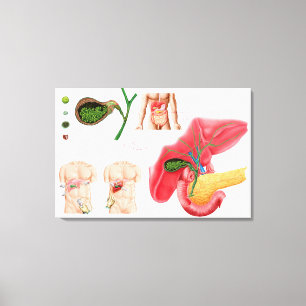 Impressão Em Tela Ilustração que descreve o Cholecystectomy