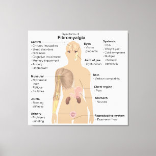 Impressão Em Tela Sinais de Gráfico Sintomas Fibromialgia Tela de im