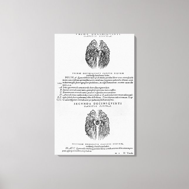 Impressão Em Tela Sistema vascular cerebral (Frente)