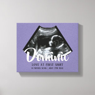 Impressão Em Tela Sonograma KeepsasaBaby Ultrasom