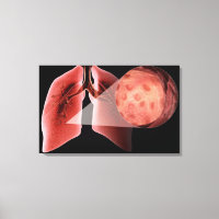 Via respiratória inflamada durante um ataque de as