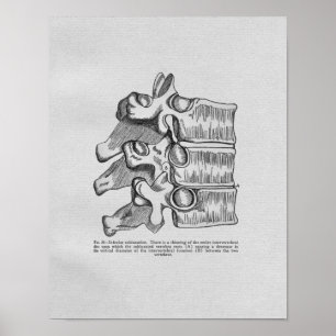 Impressão vertebral do vintage do Subluxation da