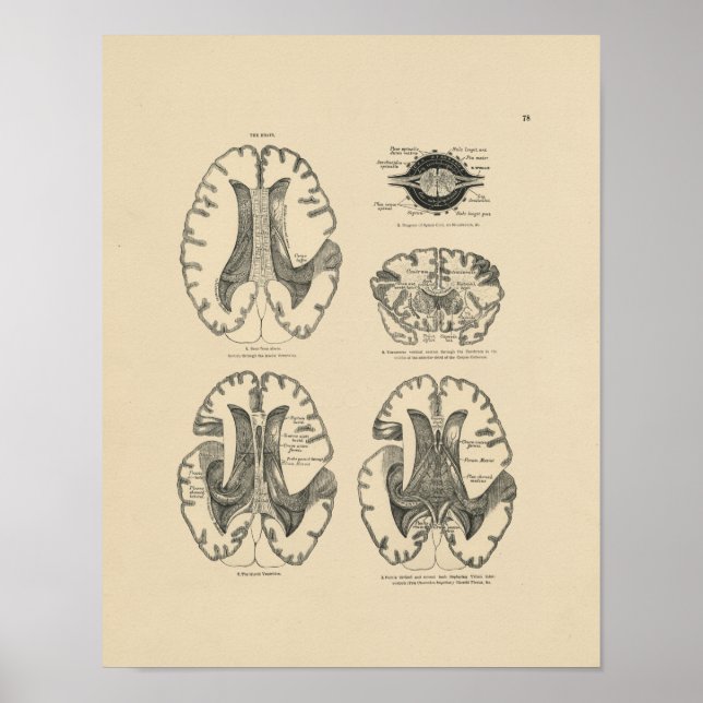 Impressão Vintage Human Brain Anatomy 1880 (Frente)