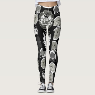 Legging é assim que a depressão se parece_CTFOD