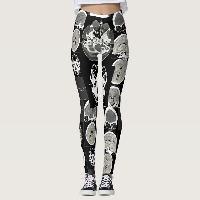 Legging é assim que a depressão se parece_CTFOD (Frente)