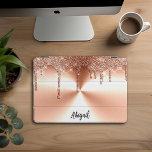 Lixo Dourado do Rosa do Luxo Disparo Glitter Pesso<br><div class="desc">Lindo brilho de Rosa de brilho de luxo Dourado com brilho com textura de metal escovado Design de iPad Pro personalizado</div>
