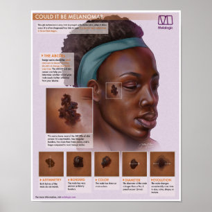 Melalogia Melanoma Poster